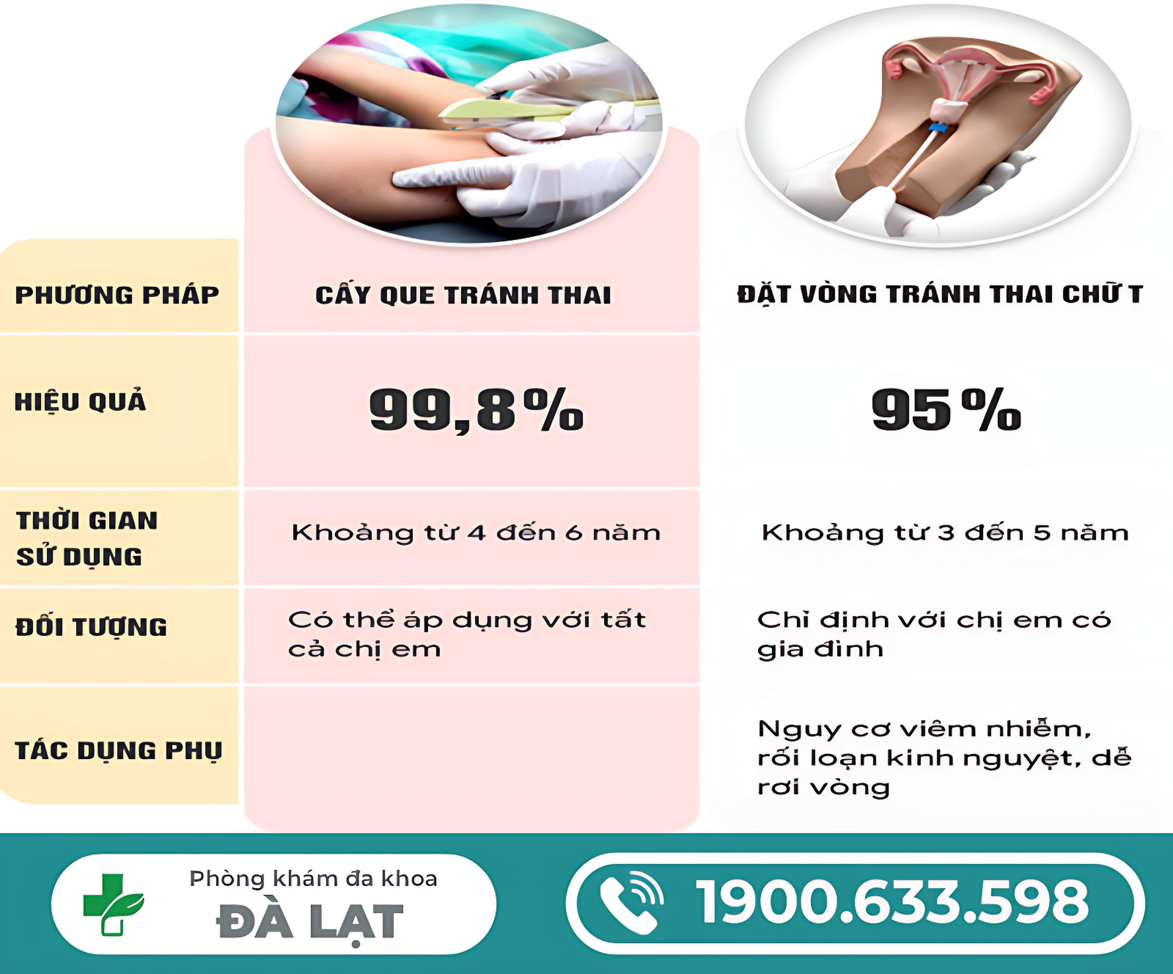 Hình ảnh minh họa